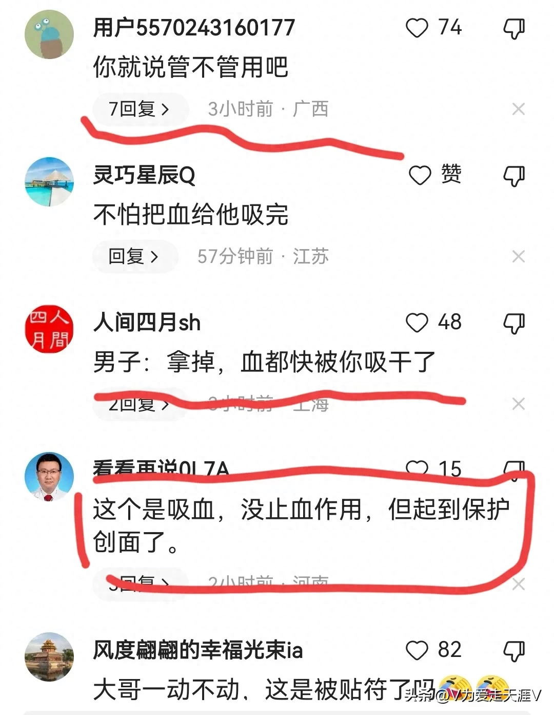 女司机撞倒行人，竟掏出如此“神器”为其止血，让人哭笑不得_女司机撞倒行人，竟掏出如此“神器”为其止血，让人哭笑不得_